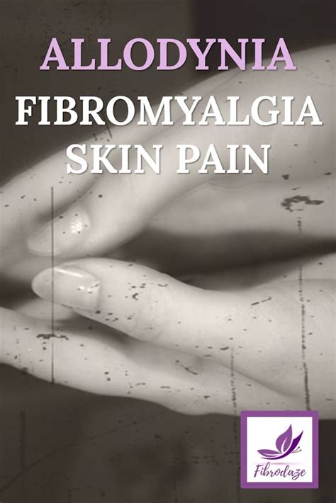 Allodynia fibromyalgia skin pain – Artofit