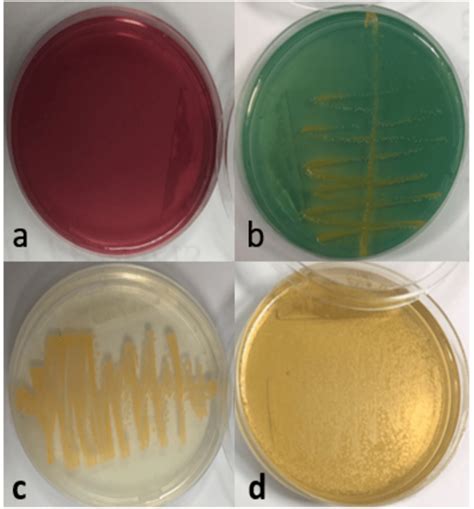 Staphylococcus Aureus On Agar