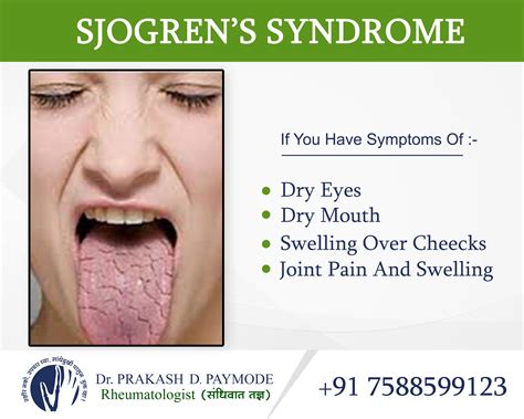 Shogren Syndrome - Dr.PrakashPaymode