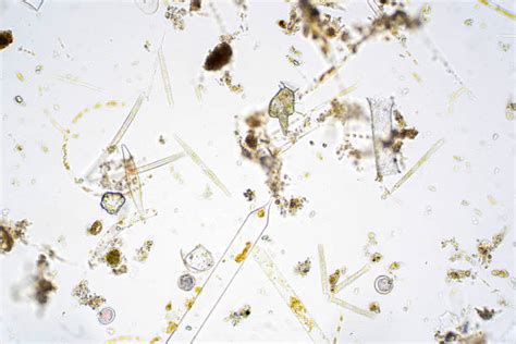 Phytoplankton Stock Photos, Pictures & Royalty-Free Images - iStock