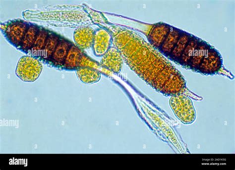 Rose spot fungus spores. Light micrograph of a section through spores from a rose black spot ...