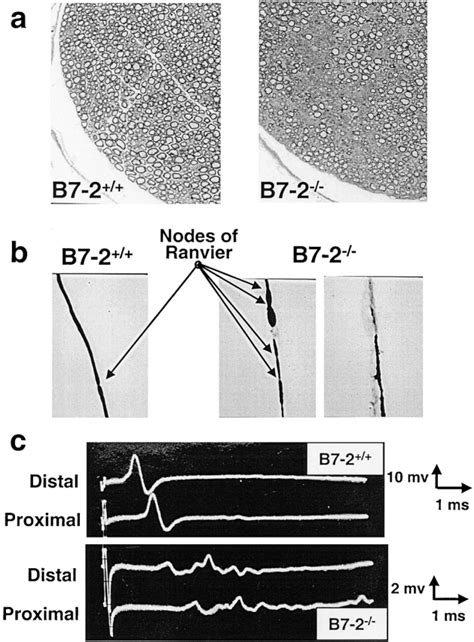 B7-2−/− neuropathic NOD mice have a demyelinating disease. (a)... | Download Scientific Diagram