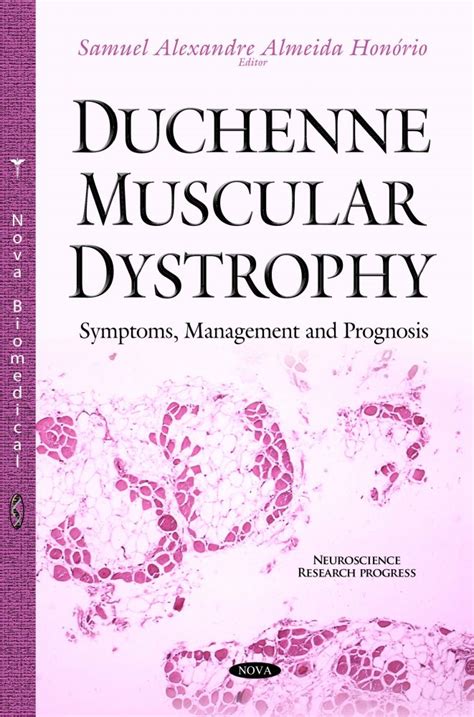 Duchenne Muscular Dystrophy: Symptoms, Management and Prognosis – Nova Science Publishers