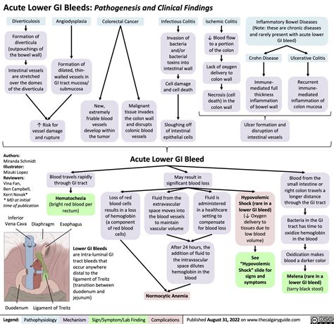 Acute Lower GI Bleeds: Pathogenesis and Clinical Findings | Calgary Guide