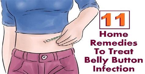 11 EFFECTIVE HOME REMEDIES TO TREAT BELLY BUTTON INFECTION | Home remedies, Remedies, Yeast ...