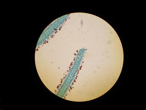 Fungi Sporulation – David Fankhauser