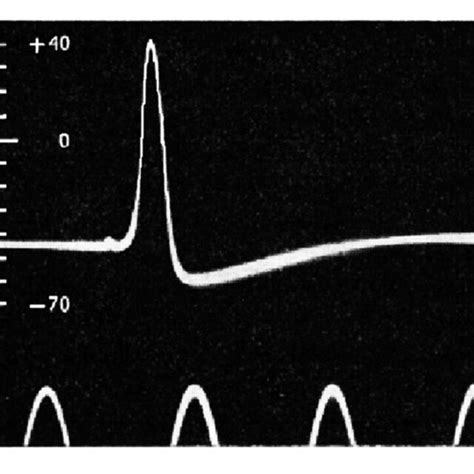 Recording of an intracellular action potential in a giant squid axon.... | Download Scientific ...