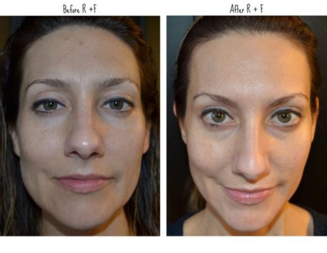 BeforeAfter - Pretty ProofPretty Proof