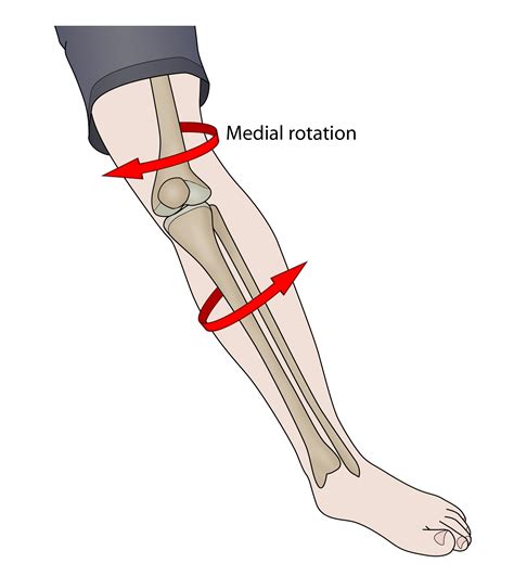 Acl Knee Injury