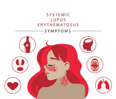 Lupus: Causes, Symptoms & Treatments