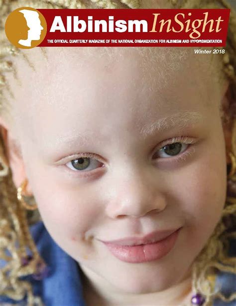 Albinism Insight - National Organization for Albinism and Hypopigmentation