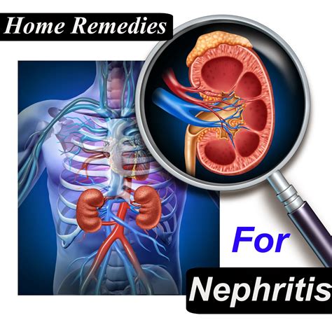 Home Remedies For Nephritis | Tips Park