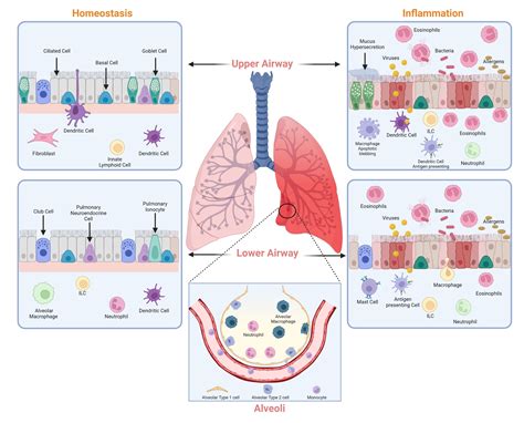 Immune Diseases Major Types Studycom