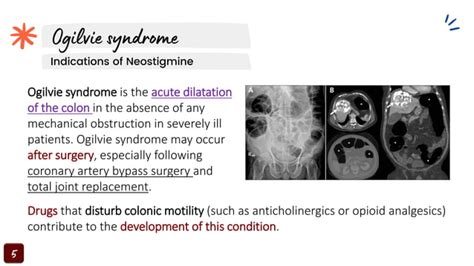 Neostigmine - Mechanism of action, indications and side effects