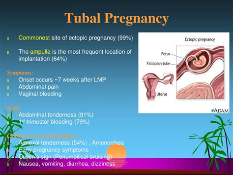 PPT - Ectopic Pregnancy PowerPoint Presentation, free download - ID:3661174