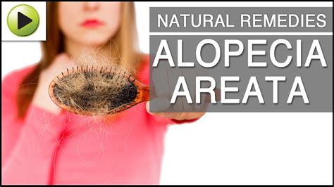 Natural Home Remedies for Alopecia Areata - YouTube