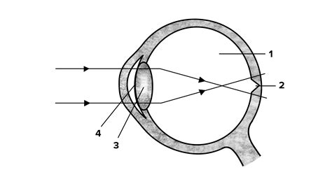 Given below is a diagram depicting a defect of the human eye. Study the ...