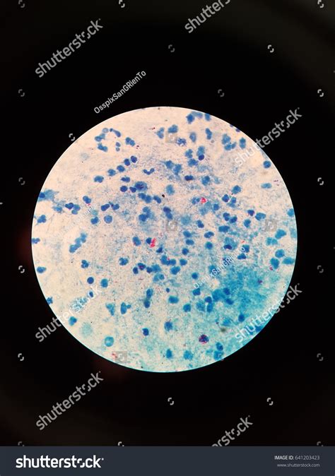 Sputum Smear Under Microscopy Showing Gram Stock Photo 641203423 | Shutterstock