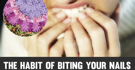 The habit of biting your nails increases the risk of infection - experts - bebetter