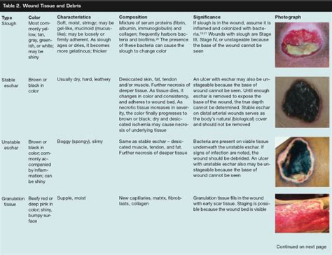 An Overview of Tissue Types in Pressure Ulcers: A Consensus Panel Recommendation