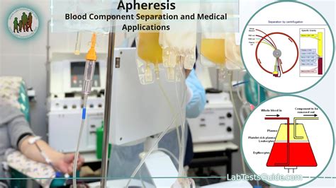 Apheresis: Blood Component Separation and Medical Applications