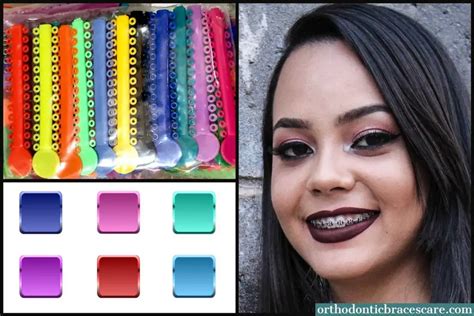 Best Braces Color For Light Skin: How To Choose - Orthodontic Braces Care