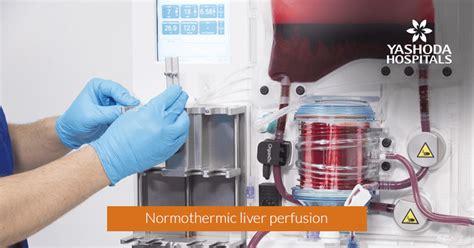 Normothermic Machine Perfusion System for Liver Transplant | A New Technology to Preserve Donor ...