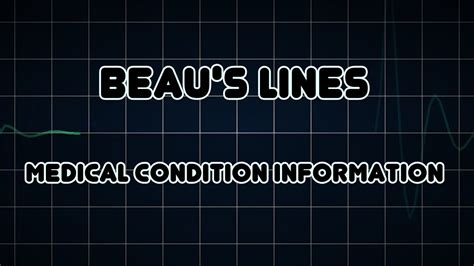 Beau's lines (Medical Condition) - YouTube