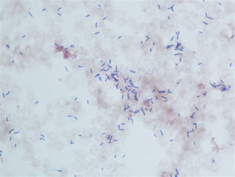 Blood cultures grew gram positive bacilli identified as Lactobacillus... | Download Scientific ...