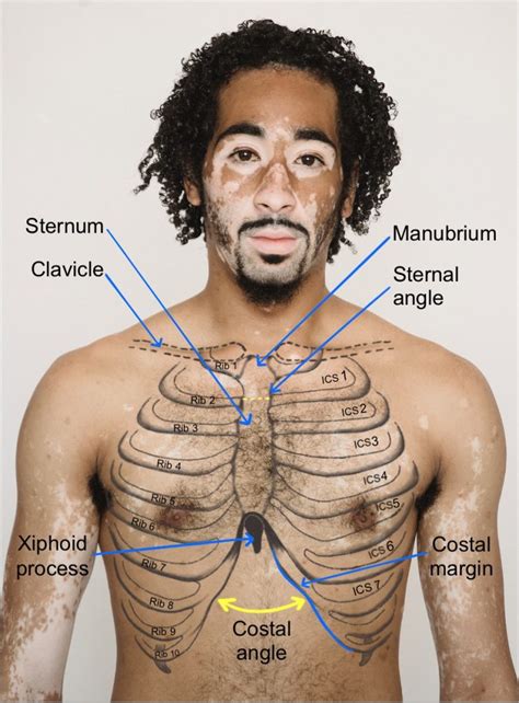 Anterior Thorax – Inspection – Introduction to Health Assessment for ...