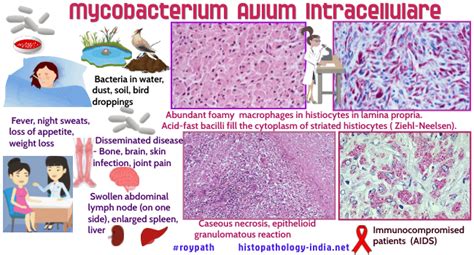 Pathology of Mycobacterium Avium Intracellulare Infection - Dr Sampurna Roy MD