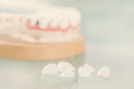 Prosthodontics Clinic In Hyderabad | Prosthodontics Implants ...