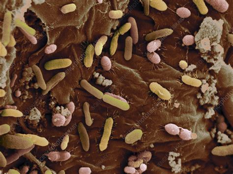 Bacteria in dog faeces - Stock Image - C017/4198 - Science Photo Library