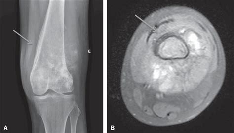 SciELO - Brasil - Diagnostic performance of magnetic resonance imaging ...