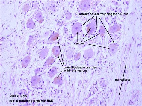 Sympathetic Ganglion | Medicine notes, Histology slides, Nervous system