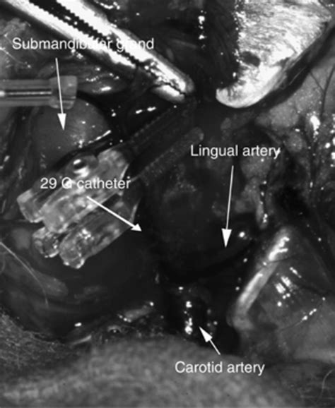 Intra-arterial infusion was accomplished by incising the midline of the ...