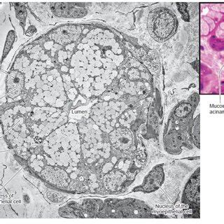 31): Showing histological sections of the submandibular gland. A ...