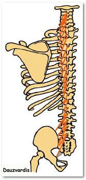 Transversospinalis-Multifidus