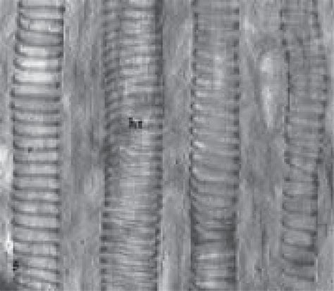 Helical thickenings (ht) of protoxylem vessels in control | Download ...