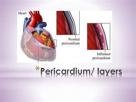 PPT - Pericardium and external features of the heart PowerPoint Presentation - ID:4328935