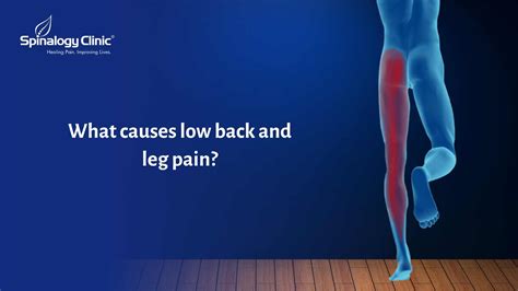 What Causes Low Back and Leg Pain? | Spinalogy Blogs | Best Back Pain, Slip Disc, Knee Arthritis ...