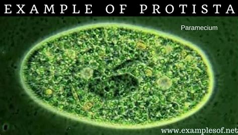 20 Examples of Protozoa (Protista) | Kingdom Protista