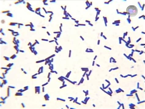 Clostridium Botulinum Gram Stain