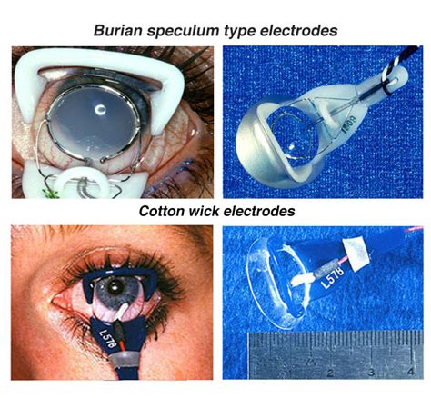 The Electroretinogram and Electro-oculogram: Clinical Applications by Donnell J. Creel – Webvision