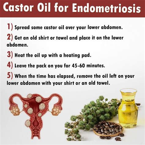 Herbal Remedies For Endometriosis