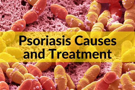 Psoriasis Causes and Treatment: A Functional Medicine Approach