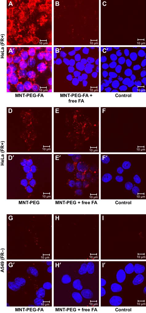 intracellular distribution of MnT-Peg-Fa labeled with alexa Fluor 647... | Download Scientific ...