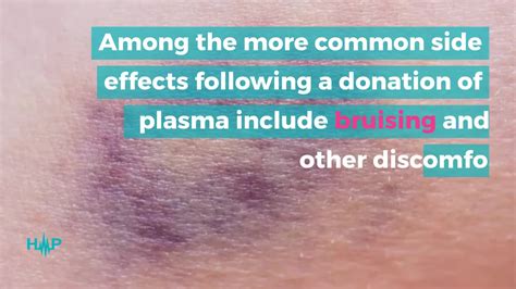 Potential Side Effects Of Donating Plasma