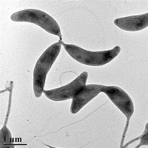 Transmission electron micrograph of Caulobacter cresentus (Berne) – Brun Lab