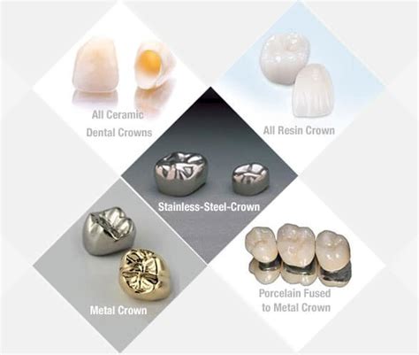 variety in crowns | Geetanjali Dental Options